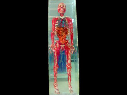 Systemic vascular with bone casting specimens