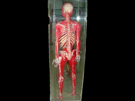 Systemic arteries with back bone casting specimens