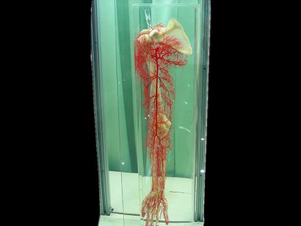 Upper limb artery casting specimens