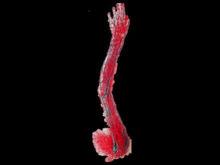 Upper limb vascular casting specimens