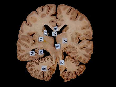 coronal section of head plastinated specimen