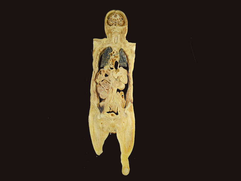 coronal section of human specimen