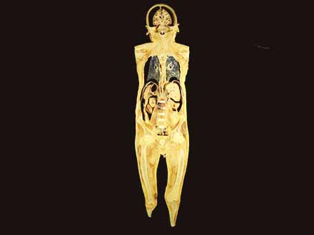 coronal section of human teaching specimen