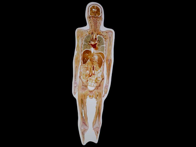 coronal section of whole body embedded specimen for medical university