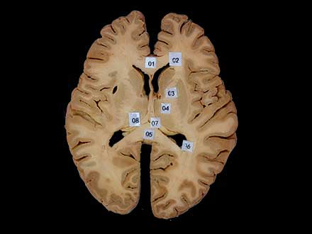 horizontal section of head plastinated specimen