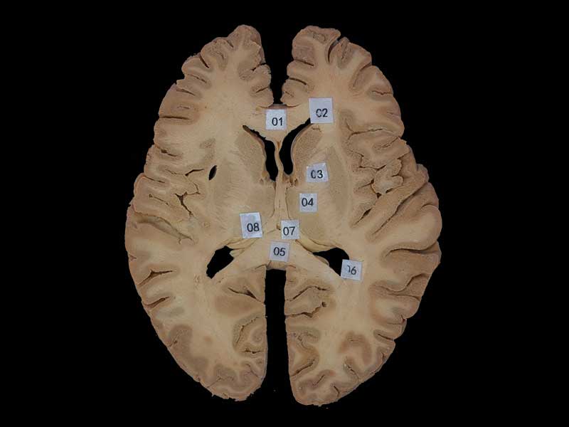 horizontal section of head plastination