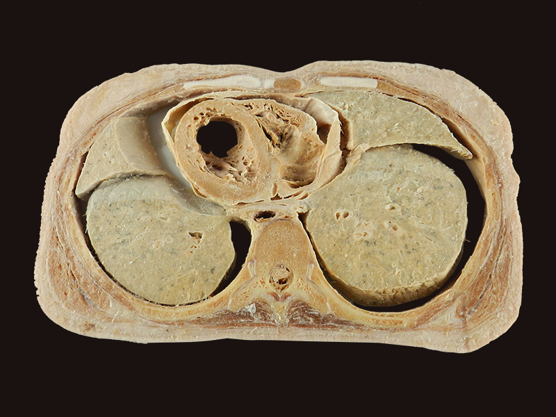 Horizontal slices of com plete female body plastinated specimen