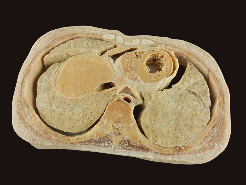 Horizontal slices of com plete female body plastination