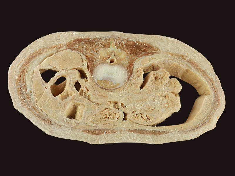 Horizontal slices of com plete female body specimen for sale