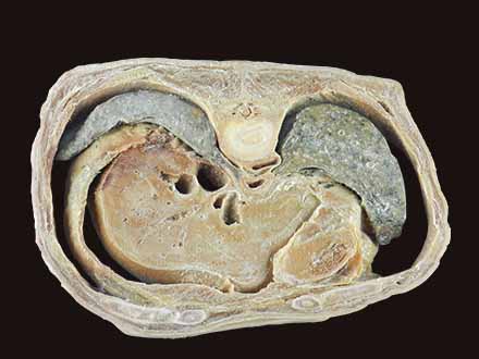 Horizontal slices of complete male body specimen