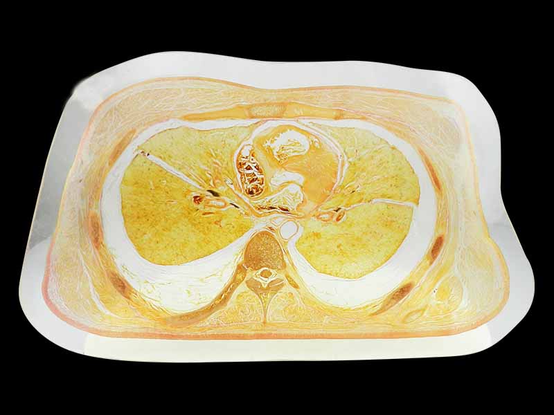medical trunk slice embedded specimen
