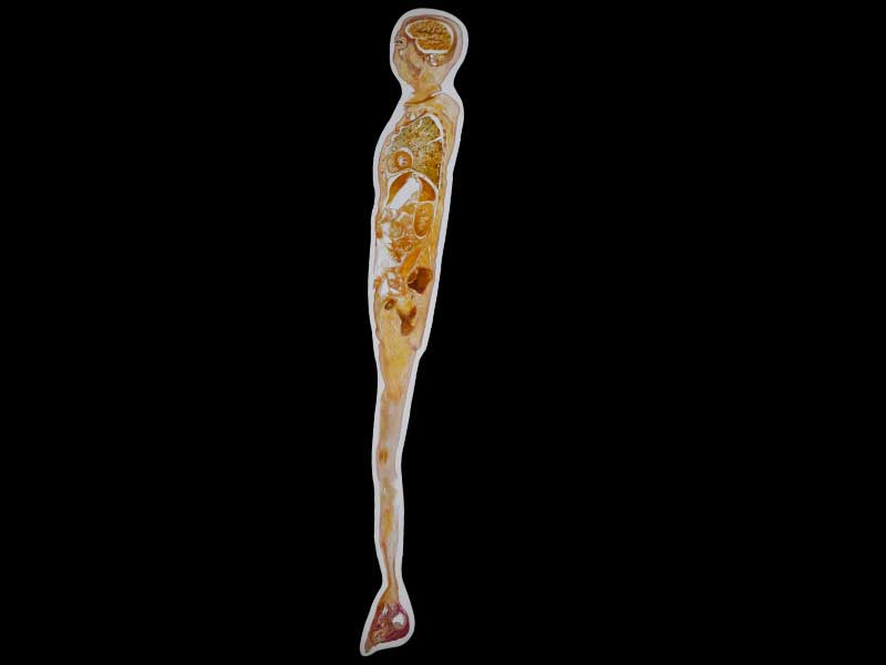 sagittal section of whole body embedded specimen for sale