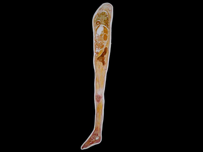 sagittal section of whole body embedded specimen