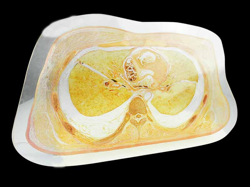 Trunk slice embedded specimen for sale