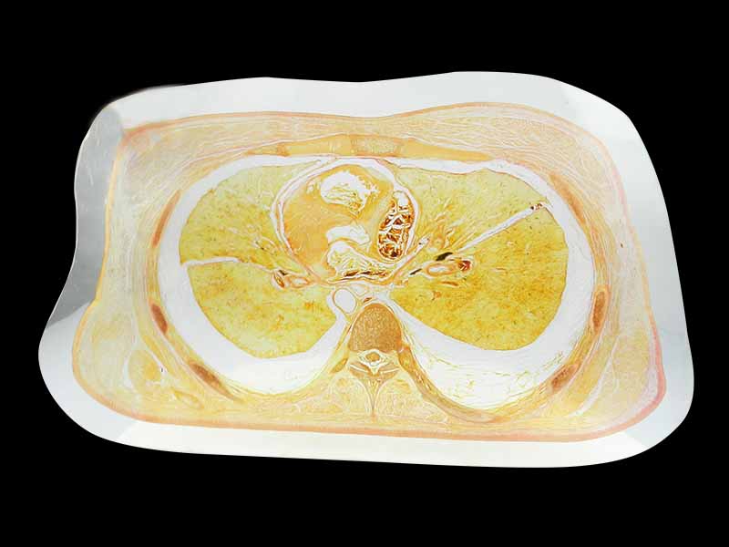 Trunk slice embedded specimen for teaching