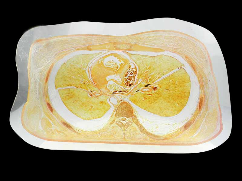 Trunk slice embedded specimen