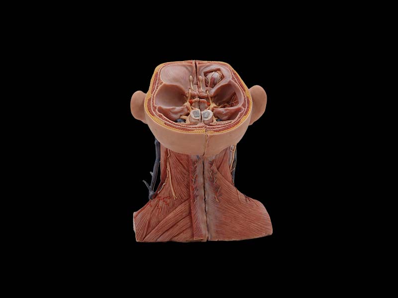 High Simulation Head Model