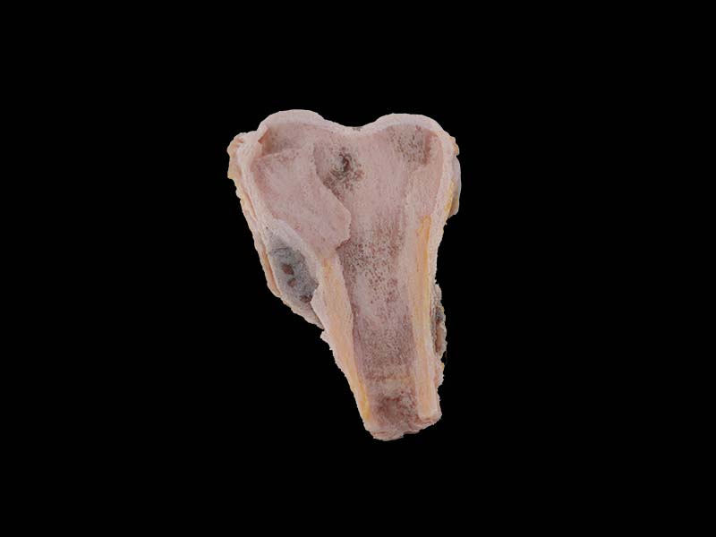 High Simulation Soft Osteosarcoma Model