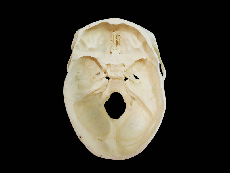 horizontal section of human skull