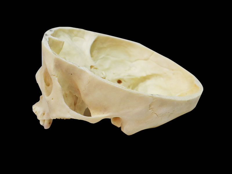 horizontal section of real skull