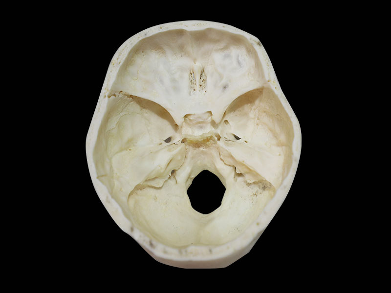 horizontal section of skull