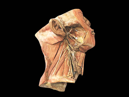 Human submandibular triangle plastinated specimen