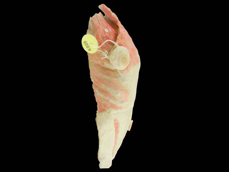 Anterior thoracoabdominal wall