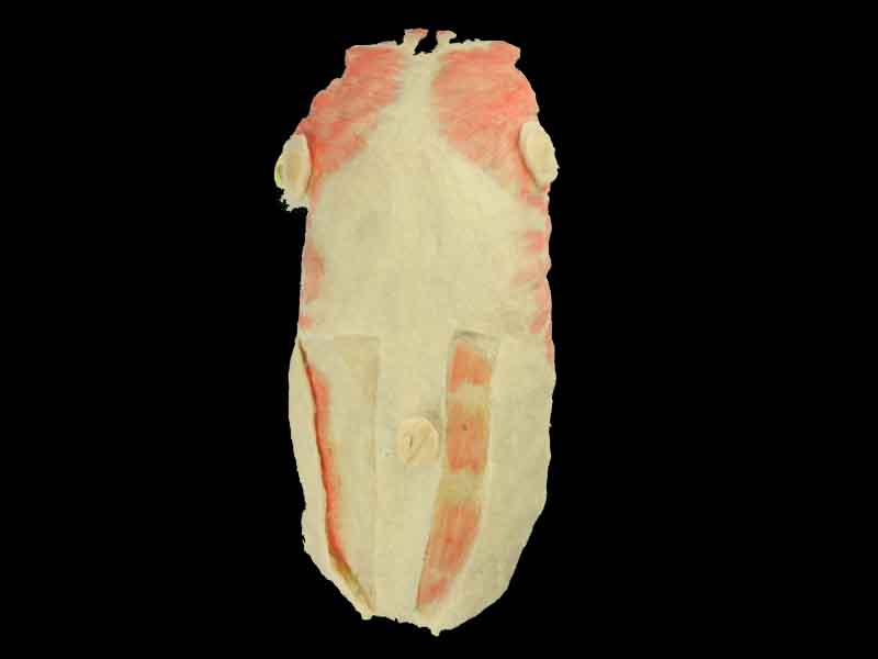 Anterior thoracoabdominal wall plastinated specimen