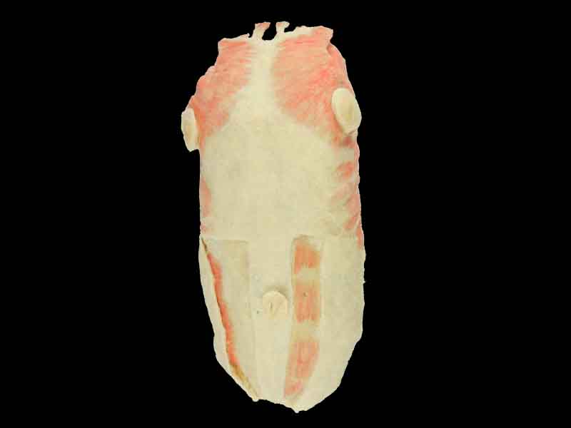Anterior thoracoabdominal wall plastination
