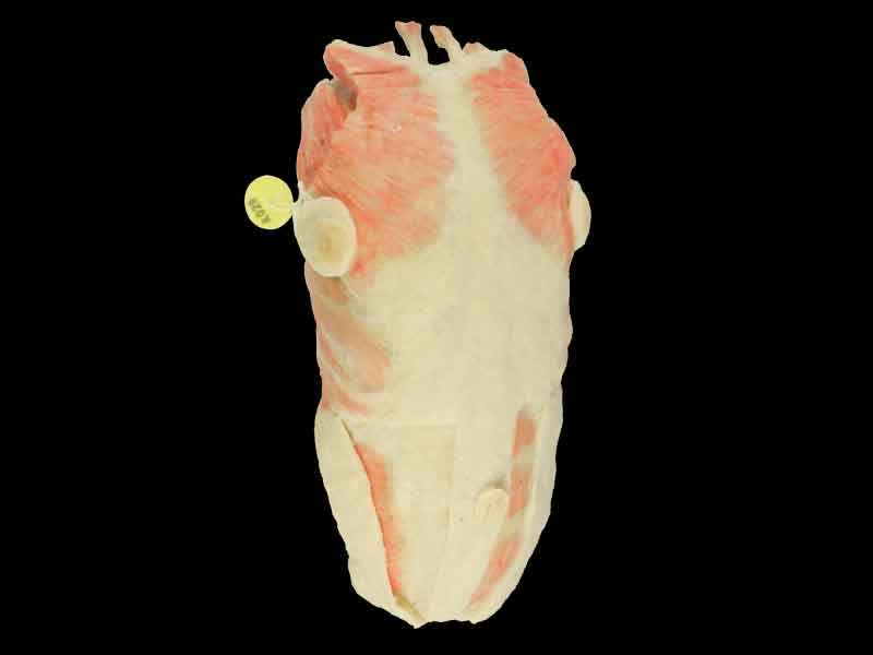 Anterior thoracoabdominal wall teaching specimen