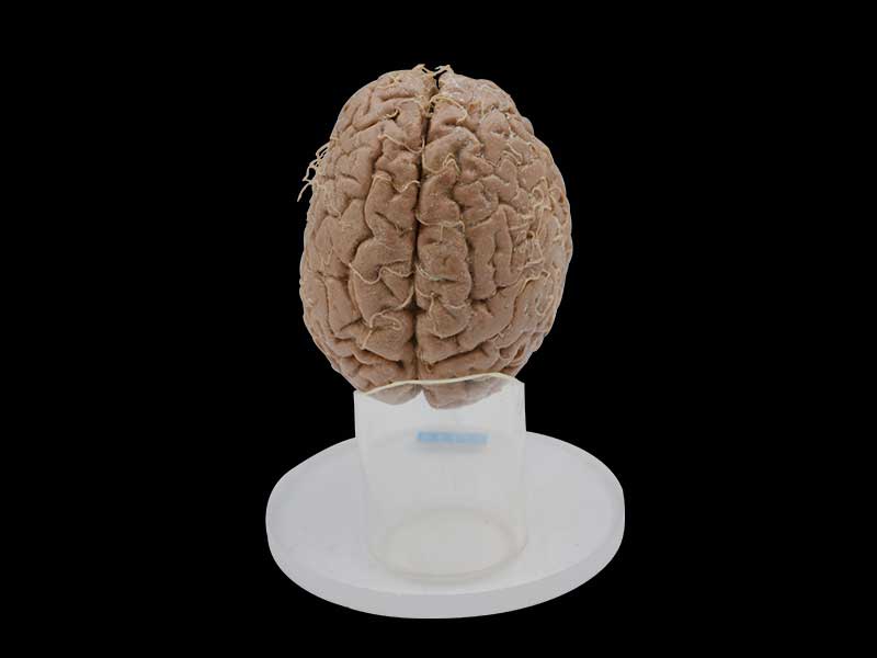 Arteries of base of brain