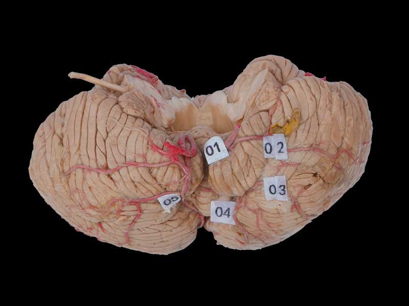 artery of cerebellum