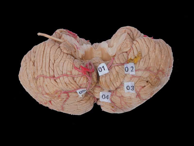 artery of cerebellum plastinated specimen