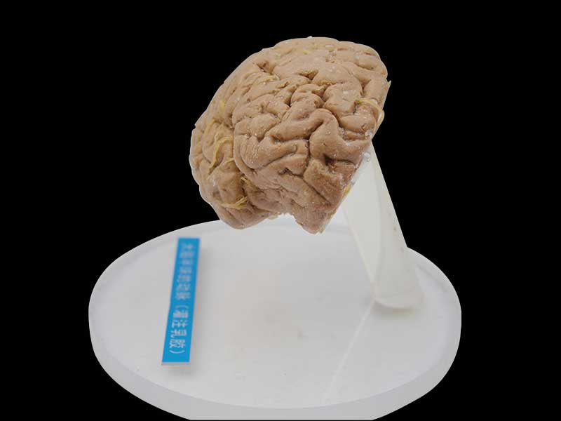 Artery of cerebral hemisphere plastination