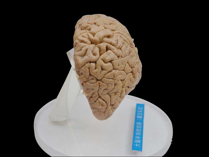 Artery of cerebral hemisphere