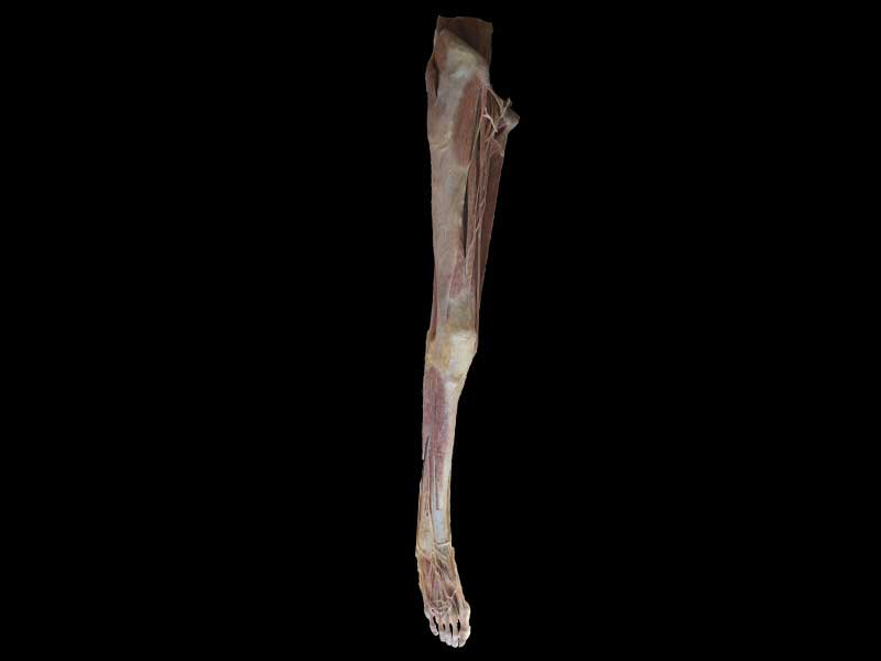 artery of lower extremity plastination specimen