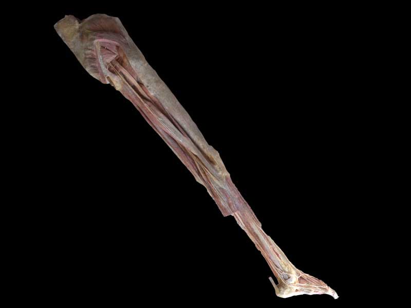 artery of lower extremity specimen