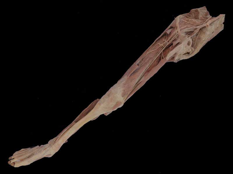 artery of lower limb plastinated specimen