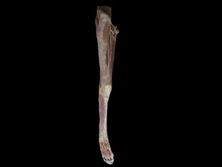 artery of lower limb plastinated specimen