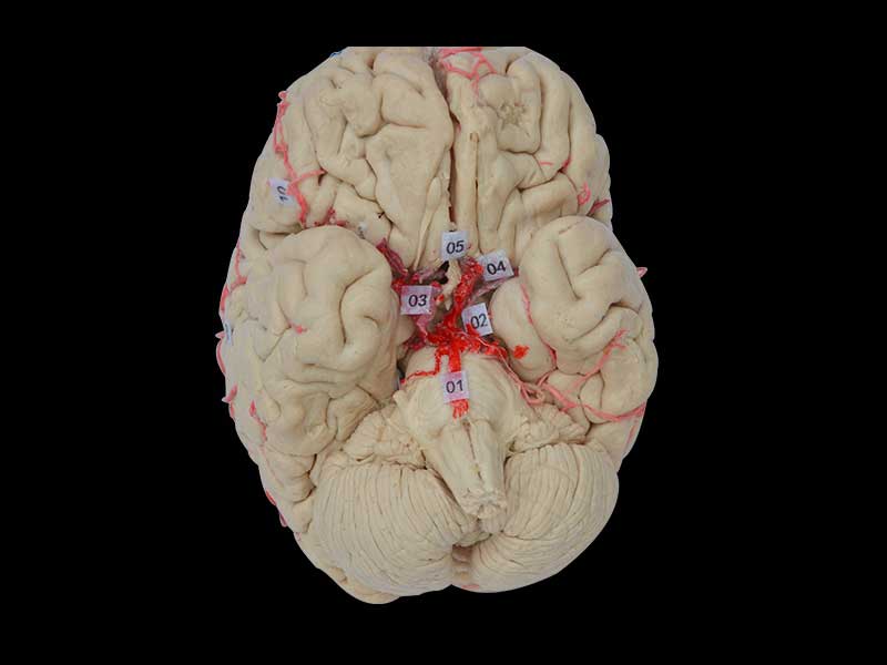 artery of whole brain plastinated specimen