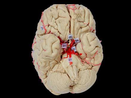 artery of whole brain plastinated specimen