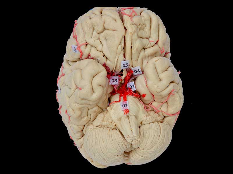 artery of whole brain plastination
