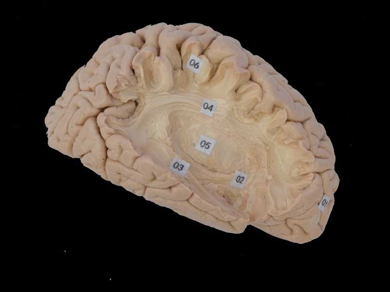 Association fiber of cerebral-hemisphere plastinated specimen