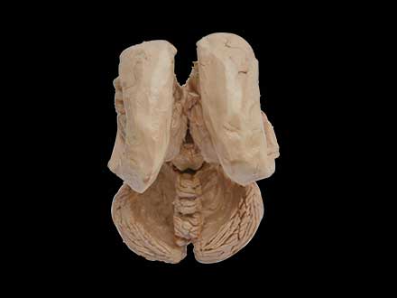 Brain stem and cerebellum plastinated specimen