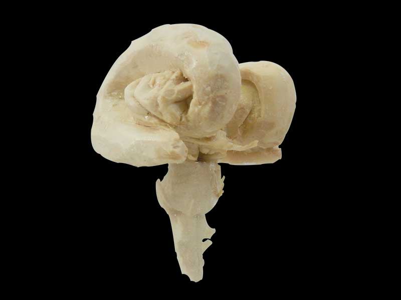 Brain stem plastinated specimen