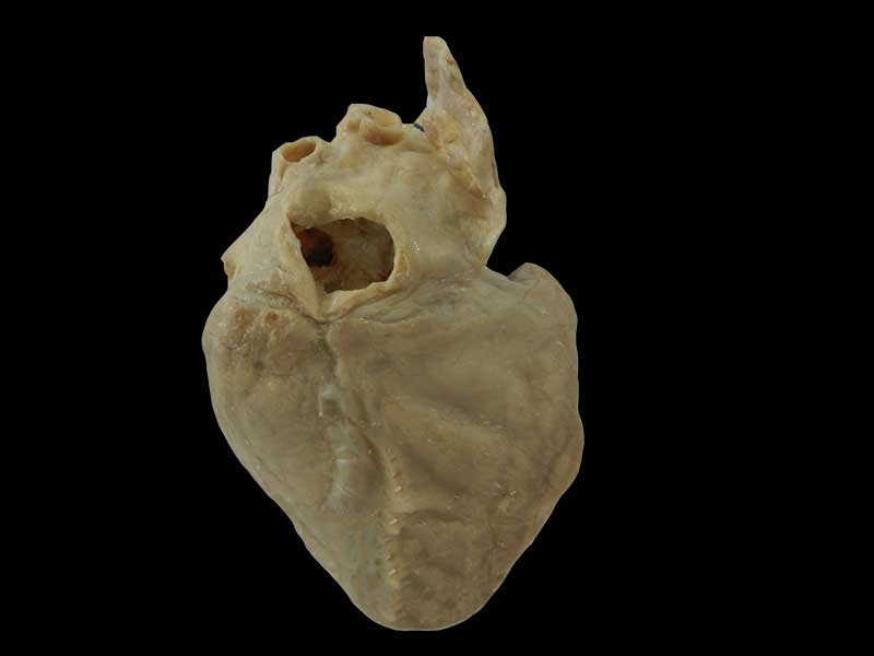 cardiac conduction system human specimen