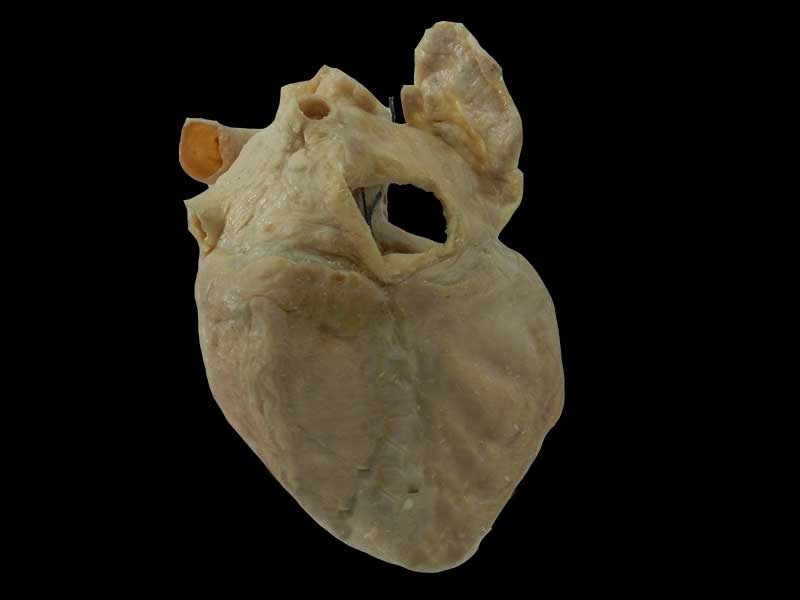 cardiac conduction system plastinated speciemen