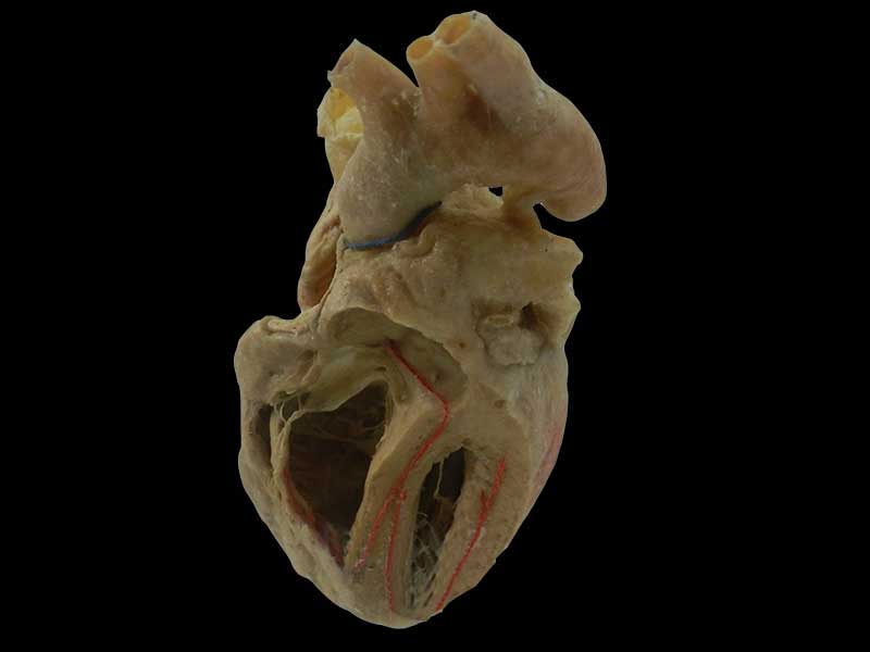 cardiac conduction system plastination specimen