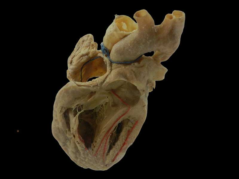 cardiac conduction system specimen