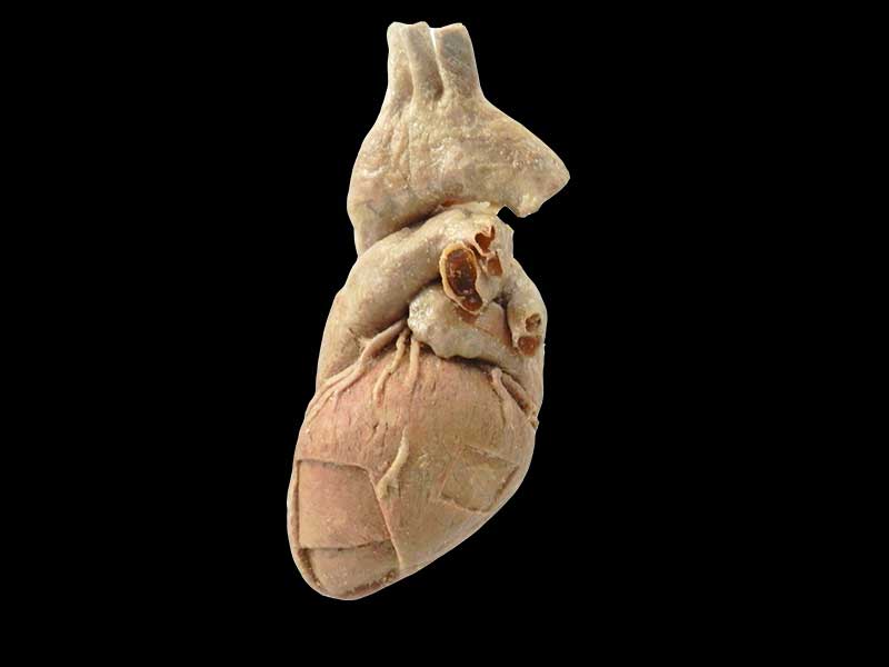 cardiac muscle human specimen
